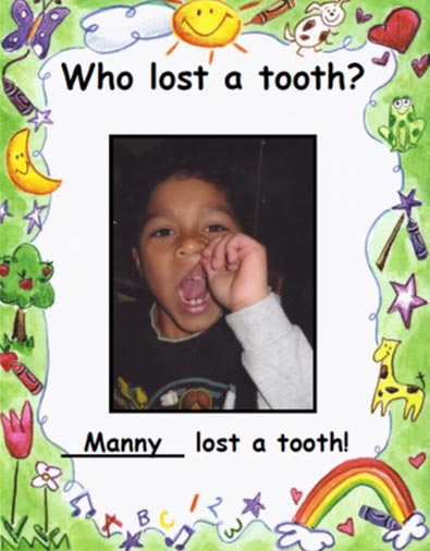 Who Lost a Tooth in Kindergarten